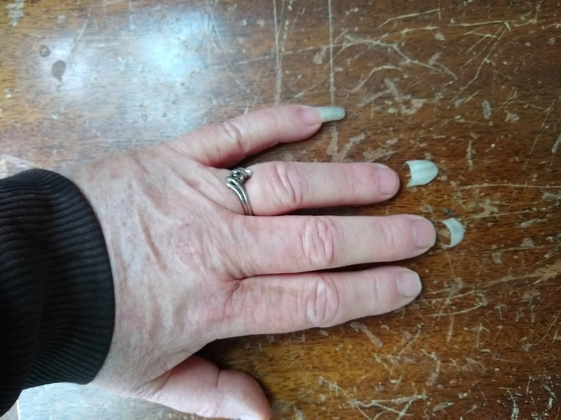 At the beginning of the week Lois has five long fingernails. By the end her left hand had one. These are strong fingernails also.