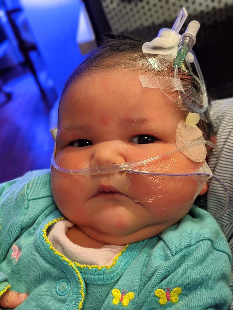 Aug 23: Fei Fei is on oxygen and has a feeding tube.