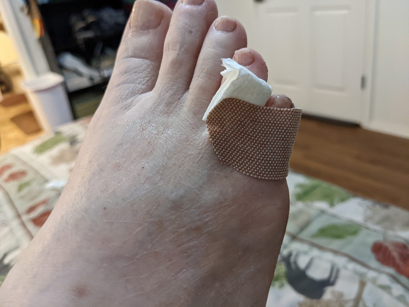 The toe, rebandaged.