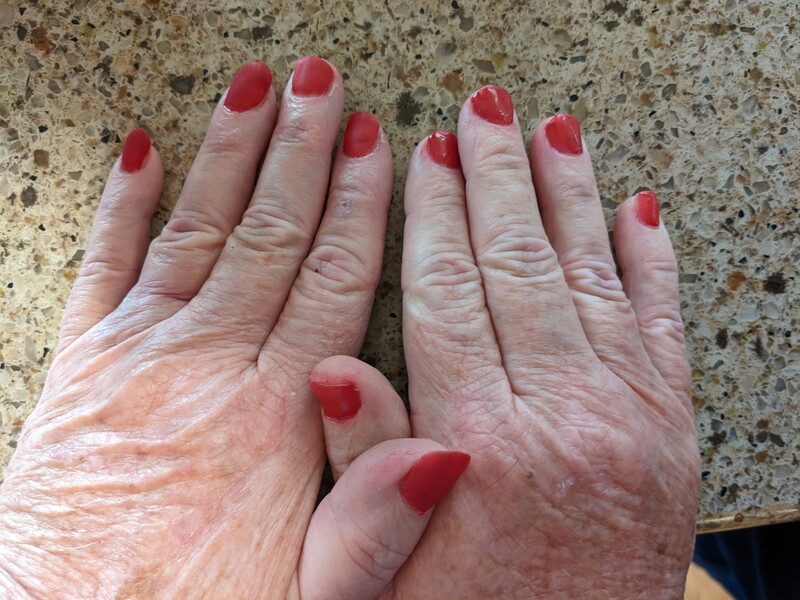 Lois's second attempt at doing gel nails.